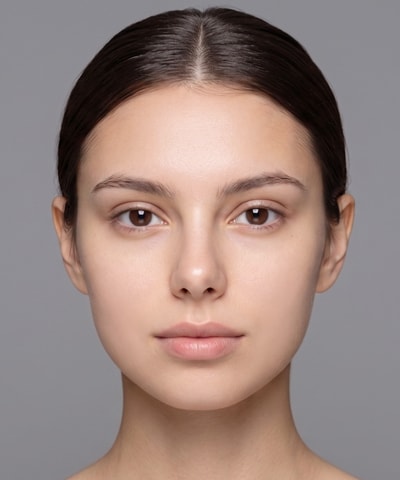 Skin Botox — the area treated, in close-up
