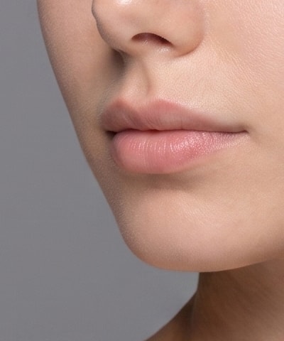 Chin Filler — the area treated, in close-up