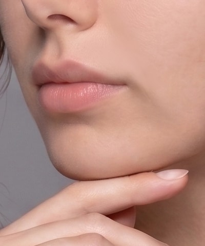 Marionette Line Filler — the area treated, in close-up
