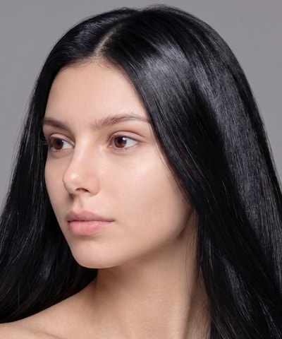 Alopecia Areata Treatment — a model showing the area this treatment addresses