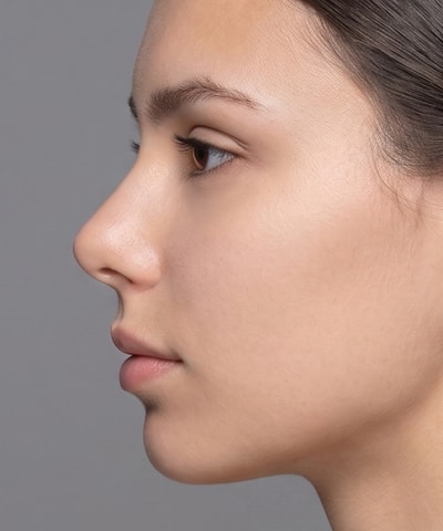 Rhinoplasty — the area treated, in close-up
