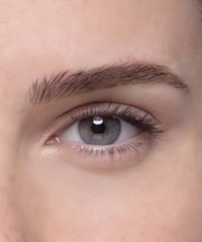 Double Eyelid Surgery — the area treated, in close-up