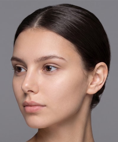 Thread Lifting — a model showing the area this treatment addresses