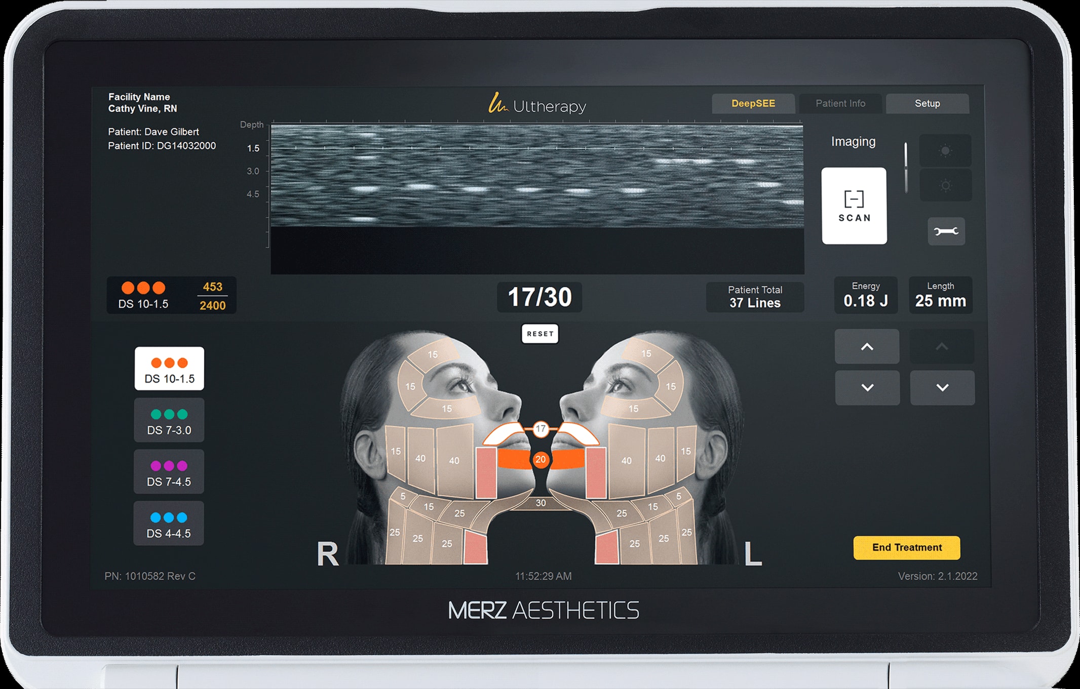 Ultherapy PRIME - Merz Aesthetics